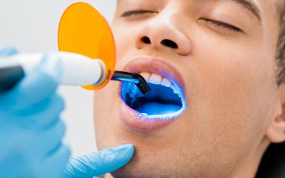 Benefits of Laser Dentistry: Why It’s the Best Choice